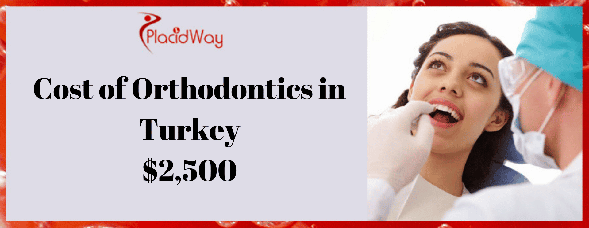 Cost of Orthodontics in Turkey